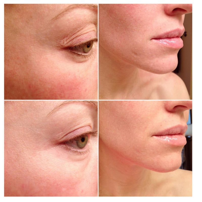 The Ordinary Multi-Peptide Anti-Aging Serum 30ml